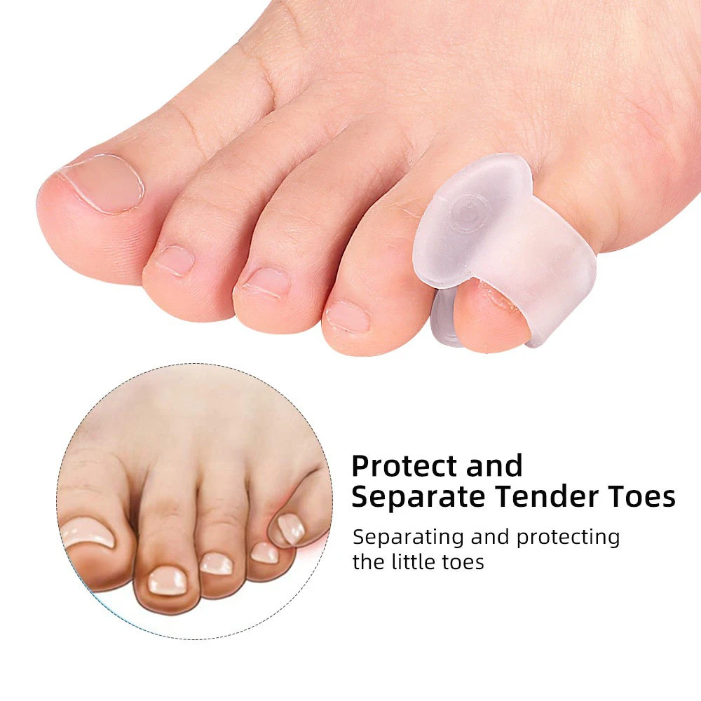 Sdotter 2шт Силиконовый Корректор для большого пальца стопы, Защита для ухода за ногами, Ортопедические Разделители для пальцев Ног, Разделитель для пальцев ног, Корректирующая накладка для ног Ca